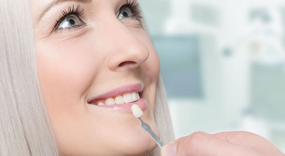 Teeth Whitening Vs Veneers Which One Is Best Stephen Petinge DMD   Veneer Benefits 